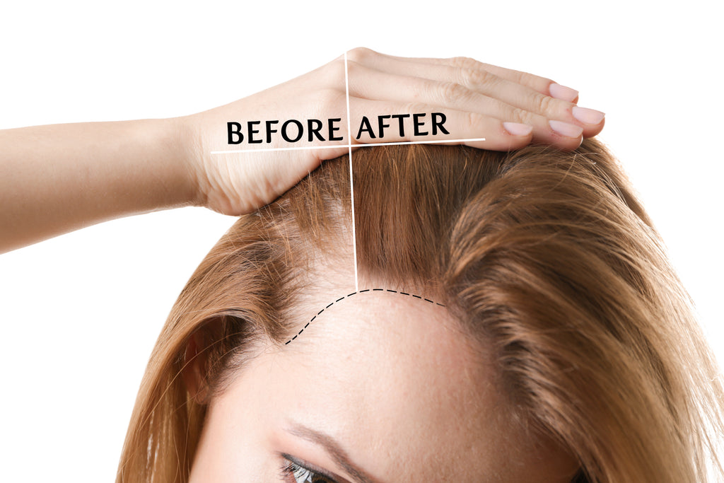 Hair Growth Oil and Thickening Scalp Treatment with Castor, Jojoba, Clary Sage, Rosemary, Nettle Extract N94772