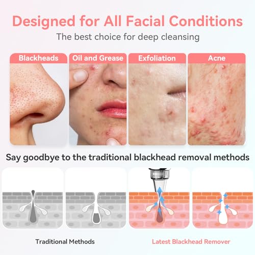 Blackhead Remover Pore Vacuum Electric Comedone Extractor Tool with 5 Suction Power and 5 Probes O630