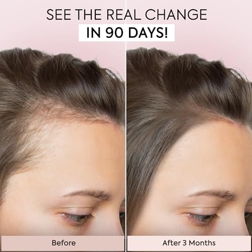 Hair Growth Serum, 1 Fl Oz W62527